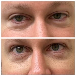 Eyeliner Tattoo result by Legacy 41 in Sea Girt, NJ