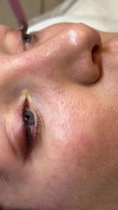 Eyeliner Tattoo result by Élevé Beauty By Marta Inc in Venice, FL
