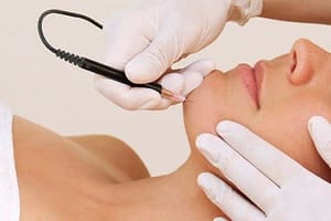 Eyeliner Tattoo result by LHR Skin and Vein Center in Rochester, MI