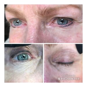 Eyeliner Tattoo result by Lips & Lashes by Crazy Aimee, LLC in South Bend, IN