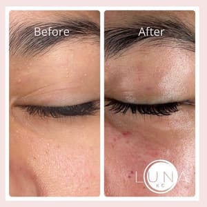 Eyeliner Tattoo result by Luna Med Spa in Kansas City, MO