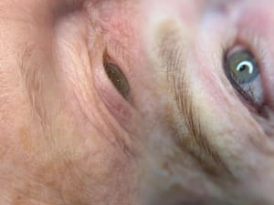Eyeliner Tattoo result by Lyna Beauty & Clinic LLC Microblading NanoHairstrokes in Frederick, MD
