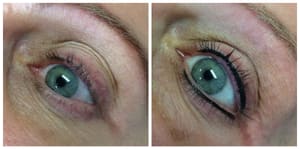 Eyeliner Tattoo result by Madison Skin Specialists in Madison, WI
