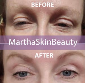Eyeliner Tattoo result by Marthaskinbeauty in Boca Raton, FL