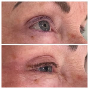 Eyeliner Tattoo result by Medical skincare with Airrisa Nuccio LLC in Vero Beach, FL