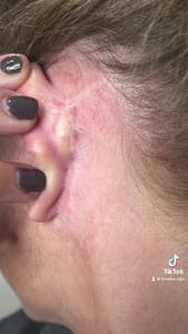 Eyeliner Tattoo result by Microblading Inked by Flawless Ego, Paramedical & Cosmetic Tattoo Artist and Educator in Mahopac, NY