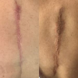 Eyeliner Tattoo result by Microblading & Lip Blushing in Culver City, CA