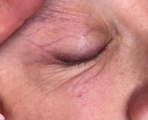 Eyeliner Tattoo result by Nanobrowart in Oakbrook Terrace, IL