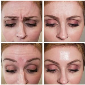 Eyeliner Tattoo result by Natalie Rose - Beauty - Med Spa - Wellness in Media, PA