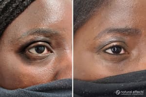 Eyeliner Tattoo result by Natural Effects Medical Tattooing in Pearland, TX