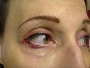 Eyeliner Tattoo result by Natural Illusions 3 locations Cumberland MD, Fairmont AND Weirton WV MAIN LOCATION FAIRMONT WV in Fairmont, WV