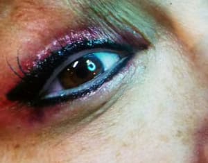 Eyeliner Tattoo result by Natural Illusions 3 locations Cumberland MD, Fairmont AND Weirton WV MAIN LOCATION FAIRMONT WV in Fairmont, WV