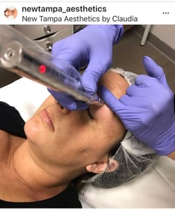 Eyeliner Tattoo result by New Tampa Aesthetics by Claudia, LLC in Tampa, FL