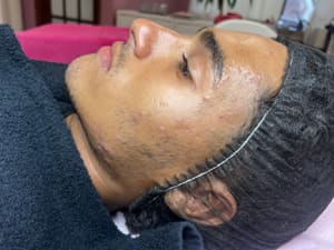 Eyeliner Tattoo result by Novera Institute in Philadelphia, PA