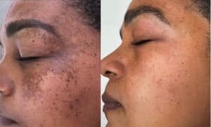 Eyeliner Tattoo result by Olivia’s Brazilian Skin Care & Brow in Stuart, FL