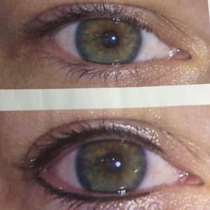 Eyeliner Tattoo result by Out of business in Phoenix, AZ