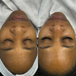 Eyeliner Tattoo result by Pearl Skinz in Burlington, NC
