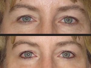 Eyeliner Tattoo result by Permanent Cosmetics Center of Montana in Bozeman, MT