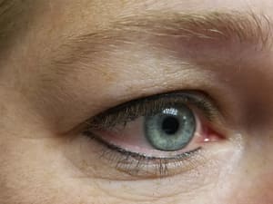Eyeliner Tattoo result by Permanent Cosmetics in New Richmond, WI