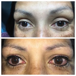 Eyeliner Tattoo result by Permanent Cosmetics of Utah by Shelly Bohman in West Valley City, UT