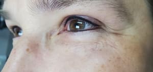 Eyeliner Tattoo result by Permanent Elegant Makeup in Kansas City, MO