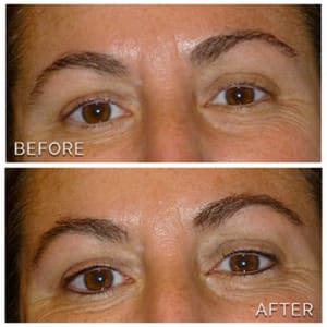 Eyeliner Tattoo result by Permanent Makeup by Ann in San Diego, CA