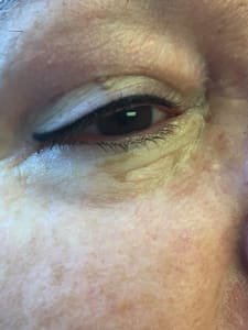 Eyeliner Tattoo result by Permanent Makeup by Chandie in Moline, IL