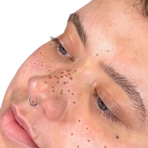 Eyeliner Tattoo result by Permanent Makeup Institute LLC in Sandy Springs, GA