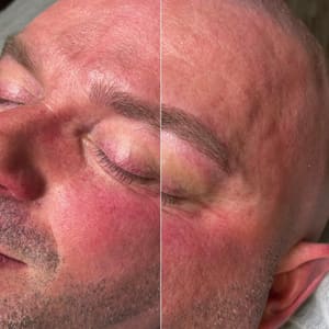 Eyeliner Tattoo result by Permanent Makeup & Tattoo Removal -D'Brow Palace Sarasota/Bradenton in Sarasota, FL