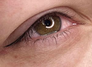 Eyeliner Tattoo result by Permanent Makeup & Tattoo Removal -D'Brow Palace Sarasota/Bradenton in Sarasota, FL