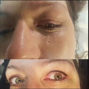 Eyeliner Tattoo result by Permanently Beautiful Solutions in Huntington Beach, CA