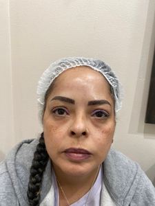 Eyeliner Tattoo result by Permanently Beautiful Solutions in Lancaster, CA