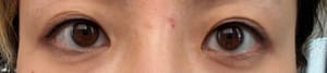 Eyeliner Tattoo result by Ping Beauty Salon in Rockville, MD