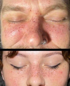 Eyeliner Tattoo result by Pins & Needles Permanent Makeup by Adelena in Lynchburg, VA
