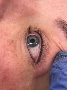 Eyeliner Tattoo result by Platinum K Aesthetics in Ellicottville, NY