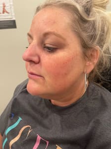 Eyeliner Tattoo result by Premier Aesthetics in Tupelo, MS