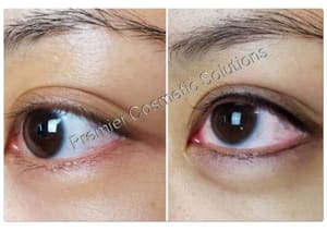 Eyeliner Tattoo result by Premier Permanent Makeup@ Imperial Salon and Spa in Melbourne, FL
