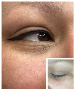 Eyeliner Tattoo result by Radiant Brows and Beauty Bar in Ocala, FL