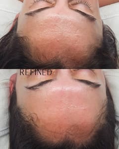 Eyeliner Tattoo result by Refined Aesthetics - St. Pete facials and waxing in Kenneth City, FL