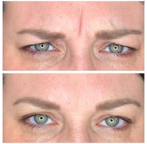Eyeliner Tattoo result by Ren Aesthetics & Wellness in Ogden, UT