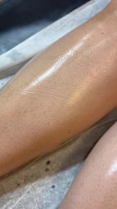 Eyeliner Tattoo result by Renewal Skin Studio in Latham, NY