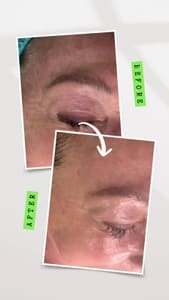 Eyeliner Tattoo result by Renu Xpert Esthetics in Sterling, VA