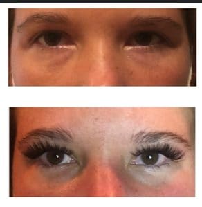 Eyeliner Tattoo result by Resolutions Med Spa in Monroeville, PA