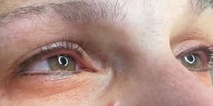 Eyeliner Tattoo result by Resolutions Med Spa in Monroeville, PA