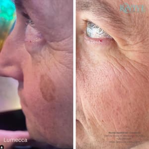 Eyeliner Tattoo result by Revive Aesthetics - Cleveland in Cleveland, TN