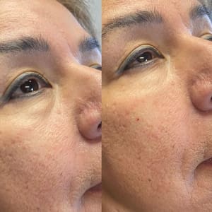 Eyeliner Tattoo result by ReVive RX Med Spa in Kansas City, MO