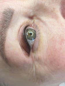 Eyeliner Tattoo result by RT Looks in Southampton, PA