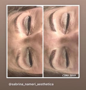 Eyeliner Tattoo result by Sabrina Nameri Aesthetica LLC in Delray Beach, FL