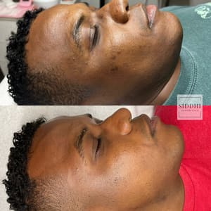 Eyeliner Tattoo result by Siddhi Aesthetics in Pensacola, FL