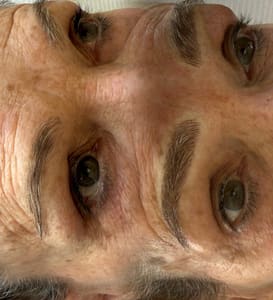 Eyeliner Tattoo result by Signature Beauty Clinic in Lakewood Ranch, FL